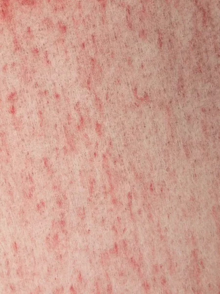 Siuvinėtas šalikas Marni raudona